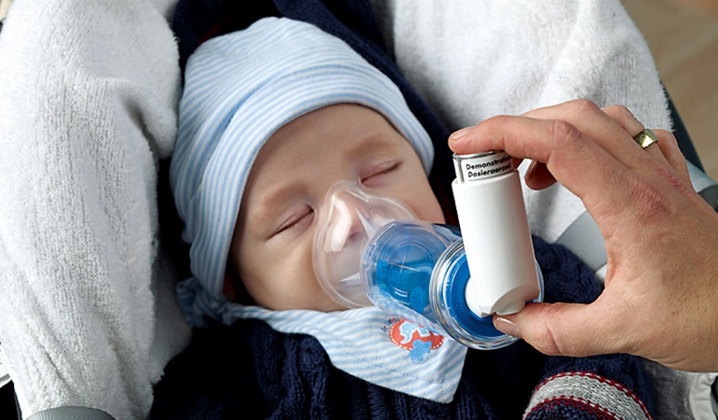 Ein schlafendes Baby erh&auml;lt eine Inhalationstherapie mit einer Inhalierhilfe und einem Dosieraerosol.